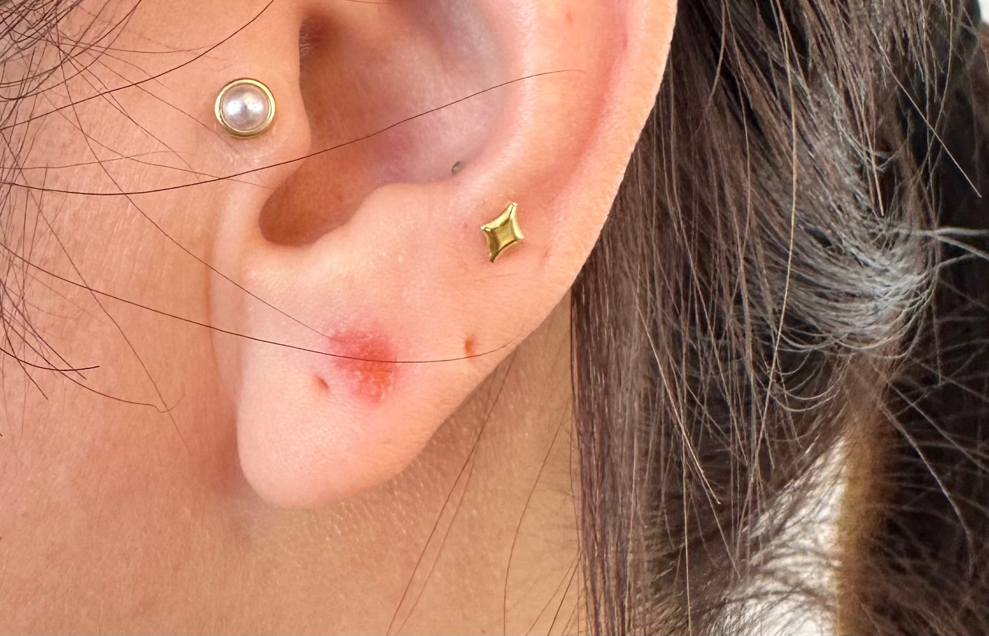 【知らないと危ない?】耳つぼジュエリーの副作用とは|安心して楽しむために知っておきたいこと